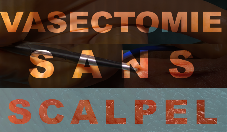 VASECTOMIE SANS SCALPEL 768x445